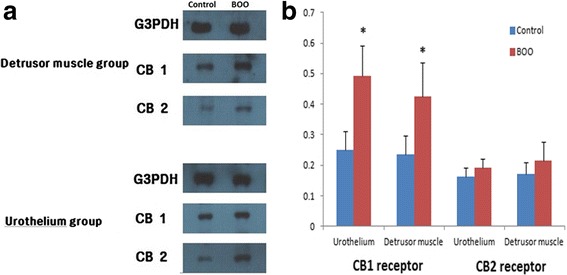 Comparison of CB1 and CB2 receptors expression levels from Western blot analysis between the control group and the BOO group. CB1 receptor expression was significantly increased in the BOO group compared to the control group (p < 0.05). Immunoreactive bands for the CB2 receptor were also increased in the BOO group, but the difference was not significant (p > 0.05) a: Western blotting b: densitometry results relative to G3PDH. Data are expressed as the mean ± SD. * < 0.05 compared with the BOO group. BOO:bladder outlet obstruction, G3PDH:glyceraldehyde-3-phosphate dehydrogenase, CB:cannabinoid