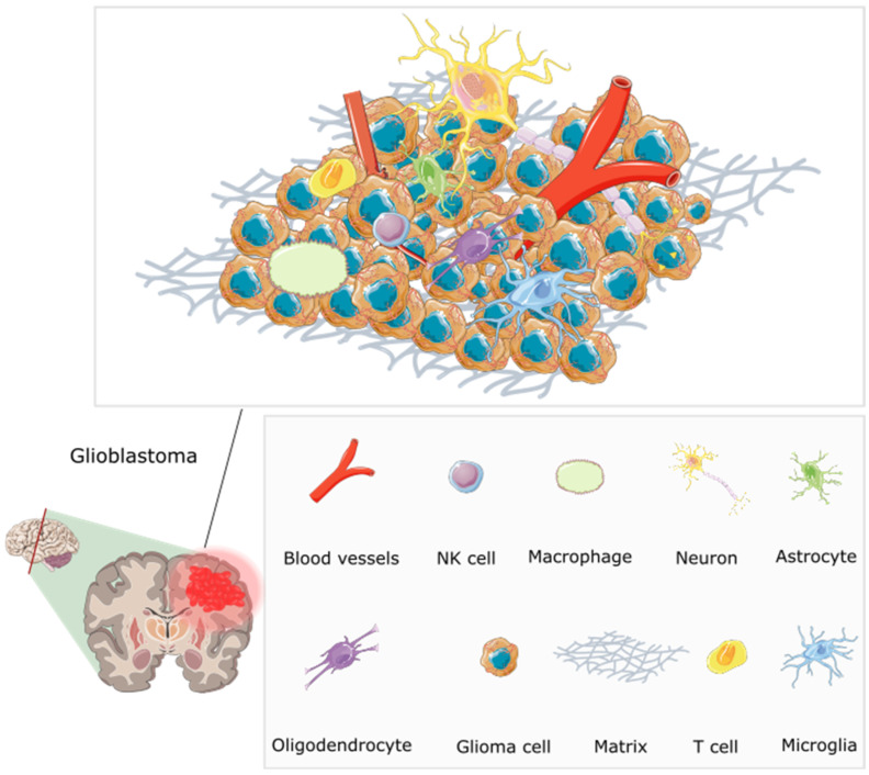 The multifaceted microenvironment of a glioblastoma, encompassing an intricate web of abnormal blood vessels, tumour cells, extracellular matrix, and immune modulators [71]. The blood vessels are twisted and irregular, characterised by hyperpermeability due to overexpression of pro-angiogenic factors including VEGF (vascular endothelial growth factor). They lack typical blood–brain barrier functions, and molecules can be seen leaking through. Tumour cells are densely packed, and interspersed immune cells such as T cells and macrophages are visible. Immune modulators, including cytokines and chemokines, are present, influencing the behaviour of tumour and immune cells. The extracellular matrix shows abnormal characteristics contributing to tumour growth. Redrawn with permission from Simon, T., Breaking through the Glioblastoma Micro-Environment via Extracellular Vesicles; published by Oncogene, 2020. CC-BY 4.0. http://creativecommons.org/licenses/by/4.0/ (accessed on 5 June 2023). The figure contains modified Images from Servier Medical Art (https://smart.servier.com, accessed on 5 July 2023) licensed by a Creative Commons Attribution 3.0 Unported License.