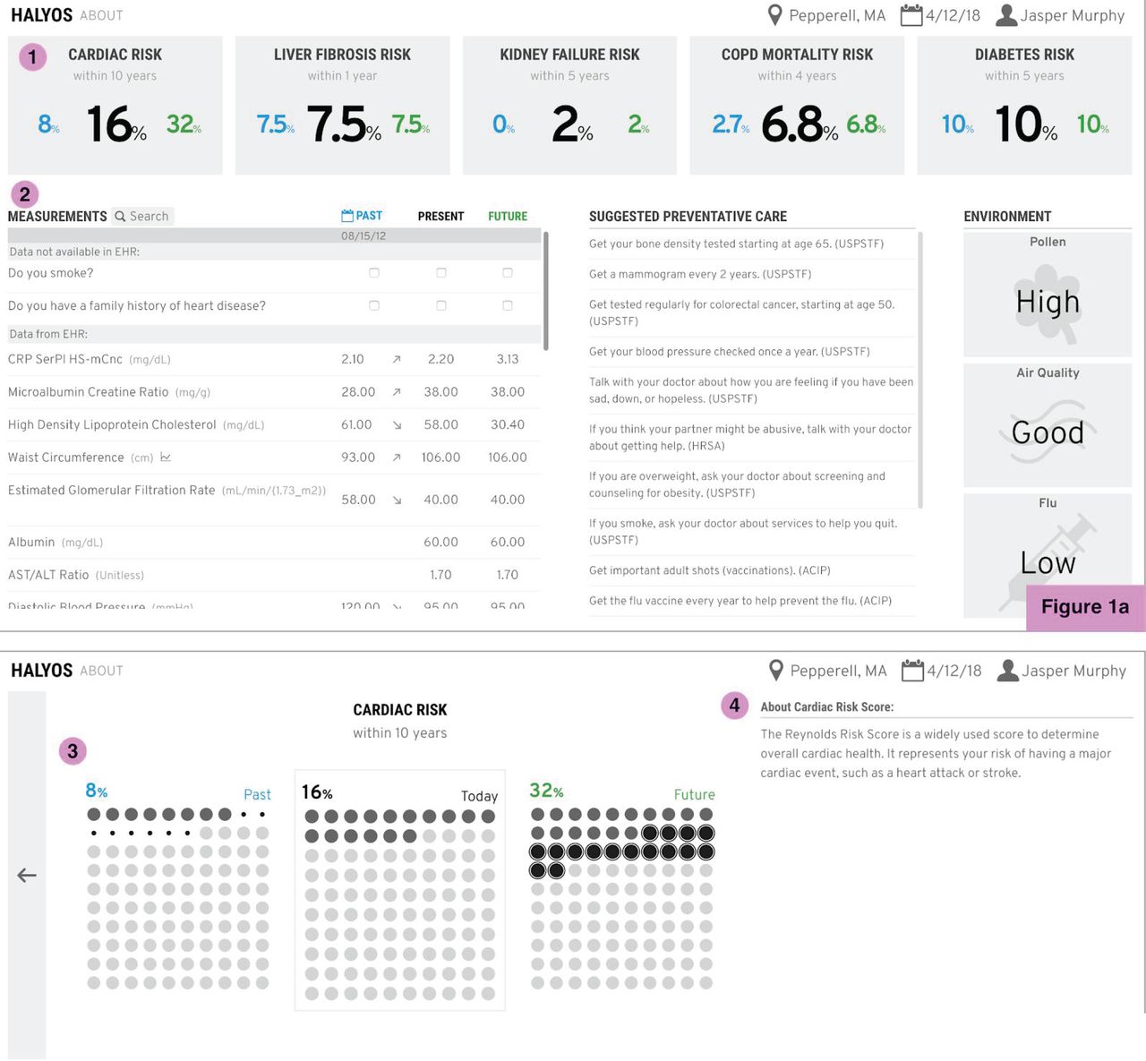 (1a, top): Home screen of Halyos. Risk scores are calculated from patient measurements and displayed as percentages (1). Individual measurement values are displayed under the Measurements section (2) with a detailed view shown in Figure 2. The dashboard also includes suggestive preventative care and environmental factors affects health risks. (1b, bottom): Expanded risk tile which displays pictorial unit charts representing a patient’s past, present, and future risk (3) with a written description of the risk score (4).