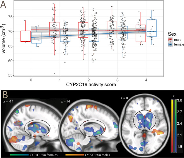 Sex differences in CYP2C19 activity effects on subcortical brain volume and in deformation-based analysis.A Effects of CYP2C19 activity on subcortical brain volume in males and females. The regression line for males runs essentially flat (in red), whereas the line for females shows an increase in volume with increasing activity scores (in light blue), so that sexual dimorphism is small or nonexistent in ultrarapid metabolizers (score = 4). Data adjusted for age, site, and cranial volume. B Statistical maps of t values obtained from the voxelwise regression of deformation values on CYP2C19 activity scores in females (in blue-green) and males (red-yellow), thresholded for display purposes at p < 0.05, uncorrected, overlaid on a template brain. Positive t values indicate larger structures. The ovals outline the effects on the basal ganglia.
