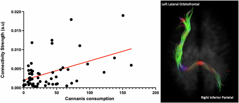 A significant positive correlation was observed between total cannabis consumption (one month prior to study) and connectivity strength between the left lateral orbitofrontal cortex and the right inferior parietal cortex in those with CUD (p = 0.0002).This critical edge encompasses several white matter tracts including left anterior and posterior corona radiata, left anterior and posterior limb of the internal capsule, left external capsule, splenium of the corpus callosum, and right cingulum.