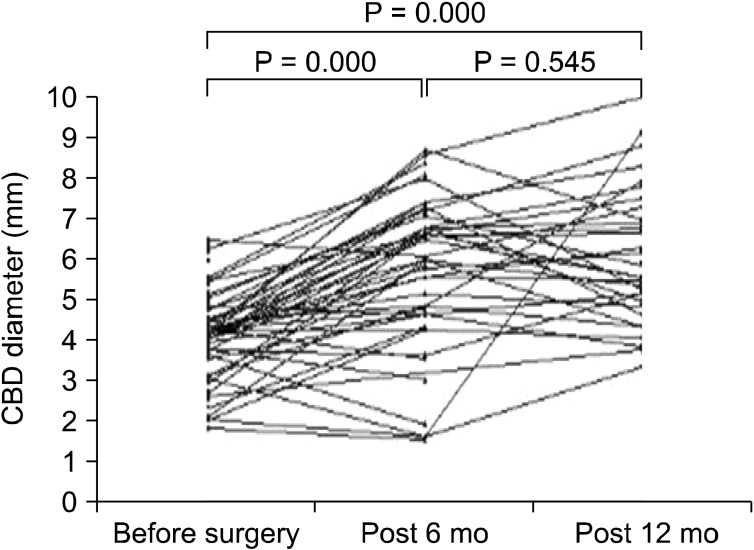 Common bile duct (CBD) diameter increase 12 months after surgery.