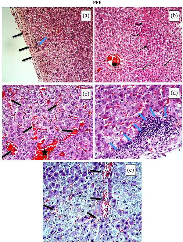 In the PFE group (PG), thickening of the Glisson capsule (thick black arrow) and mononuclear cell infiltration (blue arrows) (a, d), eosinophilic stained pyknotic nuclei cells (thin black arrows) (b), vascular congestion (black asterisks) (c), haemorrhage (thick black arrows) (c, e), and swelling of hepatocytes (e) were observed. Haematoxylin and eosin staining, magnification ×20 (a, b) and ×40 (c–e).