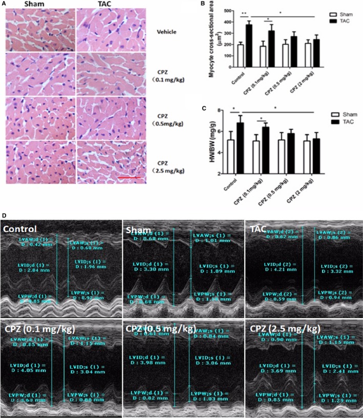 Antihypertrophy effect of TRPV1 antagonist in TAC‐treated mouse. A, Representative histological staining of cardiomyocytes in mice treated with vehicle control or CPZ (0.1, 0.5, or 2.5 mg/kg per day) at 8 weeks after TAC or sham surgery. Scale bar=25 μm. Analysis of cardiomyocyte cross‐sectional area (B) and ratio of heart weight normalized to body weight (C) was measured in the above groups (n=5 mice per group). *P<0.05, **P<0.01. D, Representative serial M‐model echocardiographic tracings in control, sham, vehicle, and CPZ (0.1, 0.5, or 2.5 mg/kg per day) treatment after TAC show LVIDs and LVIDd. CPZ indicates capsazepine; d, end‐diastole; D, diameter; HW/BW, heart weight/body weight ratio; LVAW, left ventricular anterior wall thickness; LVID, left ventricular internal dimension; LVPW, left ventricular posterior wall thickness; s, end‐systole; TAC, transverse aorta constriction.