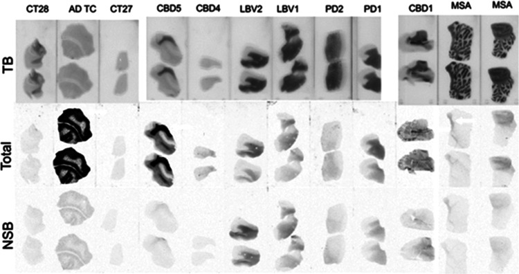 Autoradiogram using 2 nM of [3H]KAC-50.1 in fresh frozen tissues. Total binding (middle), nonspecific binding (NSB) determined after coincubation in the presence of 10 μM of KAC-50.1 (bottom), and Toluidine blue (TB) staining (top) are depicted for each slice tissue.