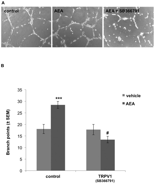 AEA-induced ECFC network-formation is efficiently reduced by the TRPV1 antagonist SB366791.(A) Representative pictures of ECFC network-formations after 12 h treatment with vehicle, anandamide (AEA, 1 µM; n = 10) or AEA + TRPV1-inhibitor (SB366791, 10 µM; n = 3), as depicted (at 10× magnification). (B) Columns represent number of branch-points formed by ECFCs. ECFCs were treated with vehicle (light grey bar) or anandamide (AEA, 1 µM; n = 10) (dark grey bar), with or without TRPV1 inhibitor (SB366791, 10 µM; n = 3), as indicated. Branch-point numbers were counted by ImageJ® (± SEM); *** indicates p ≤ 0.001 significance as compared to vehicle control. # indicates p ≤ 0.001 significance as compared to AEA only treatment.