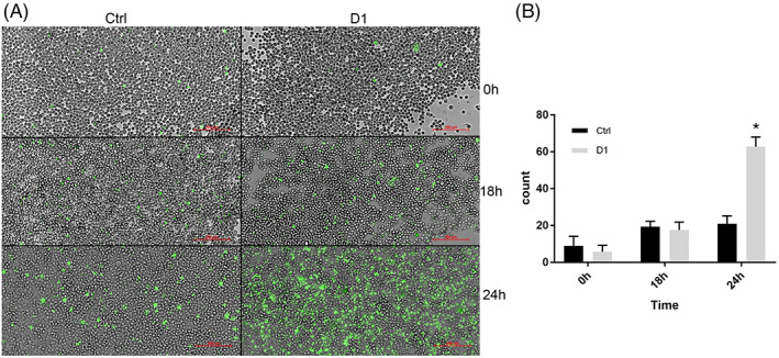(a) Live imaging microphotographs taken with a 20× objective. Caspase – activated cells (green) shown at different time points (0, 18 and 24 hr) in the control (Ctrl) and in the cells treated with D1. Scale bar (red) 200 μm. (b) Histogram of caspase – activated positive cells for each condition, *p < 0.05 compared to control. For all panels, data are expressed as mean ± SD (n = 4 per group)