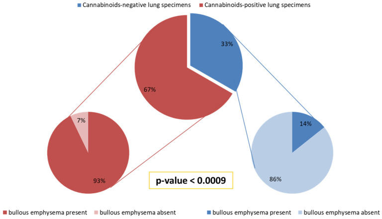 Correlation between presence of cannabinoids in lung specimens and histological findings of bullous emphysema: bullous emphysema was present in 13/14 (93%) subjects with cannabinoid-positive lung specimens, while it was found in only 1/7 (14%) of the remaining patients with cannabinoid-negative lung specimens, and the difference was statistically significant.