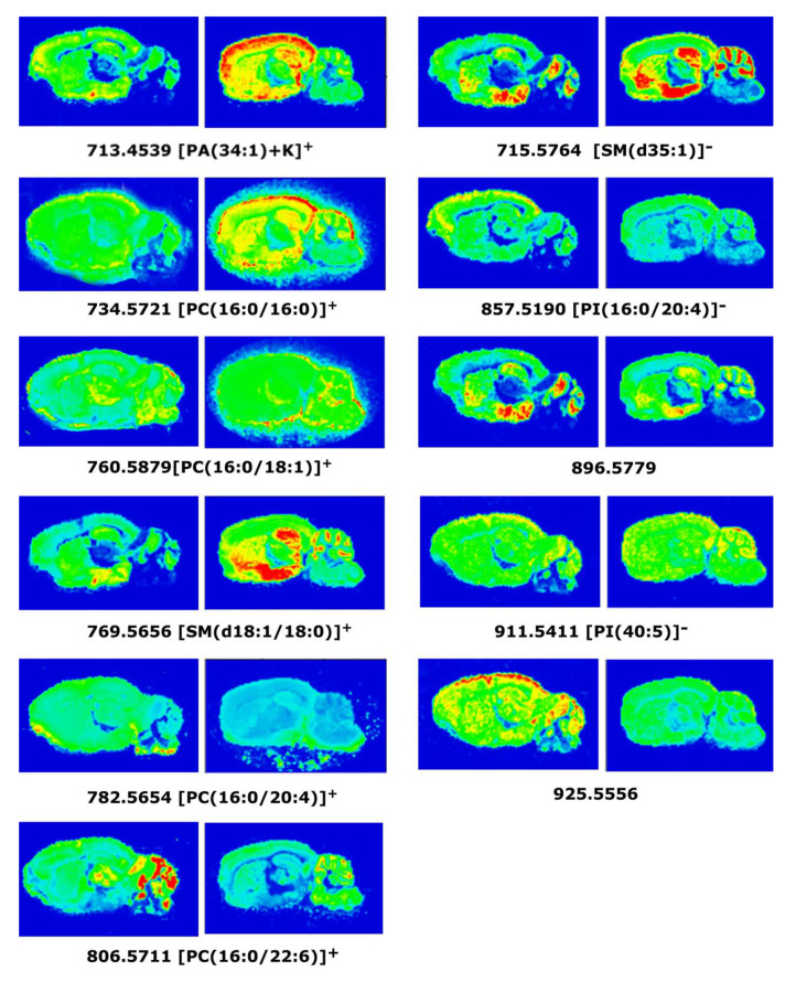 MALDI-MSI images representing different lipid species showing changes in the detection intensities between WT (left images) and 3xTg-AD (right) mice in sagittal CNS sections.