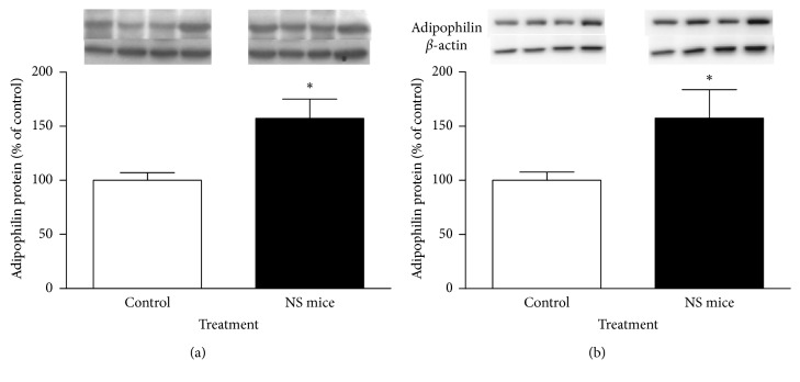 Western blot analysis of relative levels of adipophilin in epididymal fat (a) and liver (b) of control and NS mice at 150 days. For densitometry quantification purposes, β-actin was used as a loading control. Results are expressed as percentage relative to adipophilin expression in control mice. ∗P < 0.05 (Mann–Whitney U test; mean ± SEM; n=5 mice/group). Four representative blots are shown.