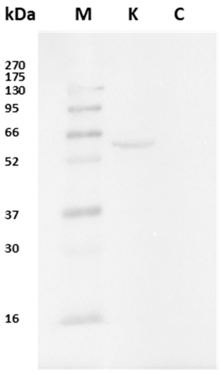 Immunoblot on eel kidney proteins. The antibody reacts with a band of about 52 kDa, corresponding to the molecular weight of CB1R. M: known molecular weight protein markers; K: kidney proteins; C: negative control shows no band.