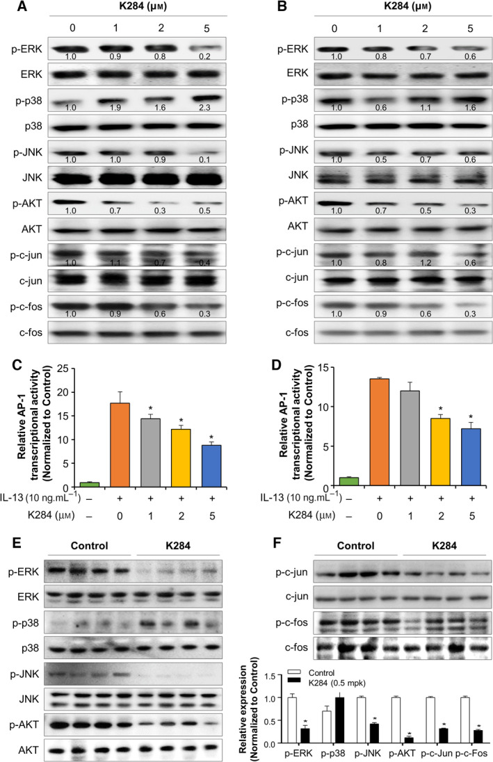 Inhibitory effect of K284 on the activation of JNK/AP‐1 signaling in A549 and H460 cell lines. (A, B) A549 (A) and H460 (B) cells were treated with 0–5 μm of K284 for 12 h. The expression of activated MAPK such as p‐ERK, p‐p38, p‐JNK, and p‐AKT and the nuclear components AP‐, p‐c‐Jun, and p‐c‐Fos from the total cell lysates was determined by western blotting. The values below the bands represent the band density. (C, D) AP‐1 consensus sequence containing the luciferase vector was transfected into A549 cells (C) or H460 cells (D). Cells were pretreated with K284 (0–5 μm) for 1 h and were then incubated with IL‐13 (10 ng·mL−1) for 6 h. AP‐1 transcriptional activity was measured by luminescence. *P < 0.05 (vs. control). (E, F) Western blot analysis for p‐ERK, ERK, p‐p38, p38, p‐JNK, JNK, p‐AKT, AKT, p‐c‐jun, c‐jun, p‐c‐fos, and c‐fos from the melanoma lung metastatic tissue lysate. The relative protein expression in the K284‐treated group compared with that in the control group is shown in the graphs. *P < 0.05 (vs. control). All error bars of graph reported are the standard deviation (SD) from three independent experiments.