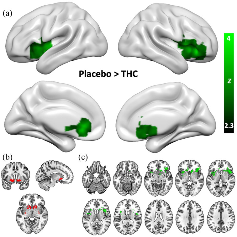 Drug effects on brain-wide connectivity with the limbic striatum in study 1. Contrast is placebo > THC. Clusters represent a significant decrease in functional connectivity with the limbic striatum in the active drug condition. (a) Significant clusters on 3D cortical surface renders. (b) The limbic striatum seed-region. (c) Significant clusters on axial slices. The THC + CBD condition showed no significant effects for this seed-region.