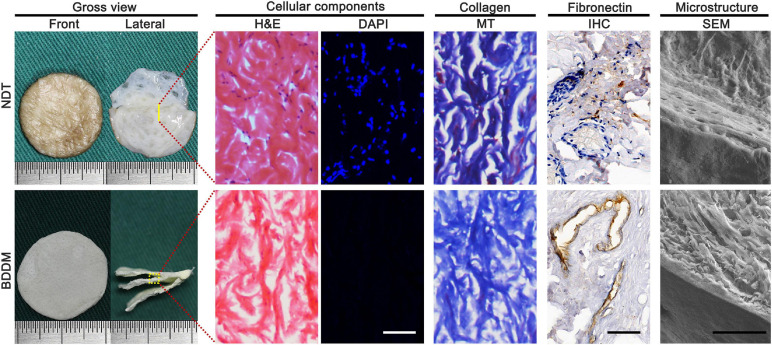 Gross observation, cellular components, collagen and fibronectin preservation, the microstructure of the native dermal matrix, and book-shaped decellularized dermal matrix. Bar = 100 μm.