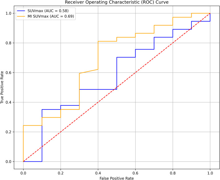 Receiver Operating Characteristic (ROC) curve for SUVmax and MI SUVmax.
