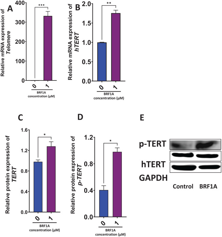 BRF1A enhanced the mRNA and protein expression of telomerase reverse transcriptase in IgE-producing myeloma cells. Myeloma cells were cultured with BRF1A at 1 µM for 48 hours, and mRNA was determined using qRT-PCR as described in the section “Materials and Methods.” mRNA expression of (A) telomere. (B) hTERT. Western blotting assay was conducted as described in the section “Materials and Methods.” Protein expression of (C) TERT. (D) p-TERT. (E) Western bands.Data represent triplicate experiments and are expressed as mean ± SD. *P < .05; **P < .01; ***P < .001 versus control (0.1% DMSO).