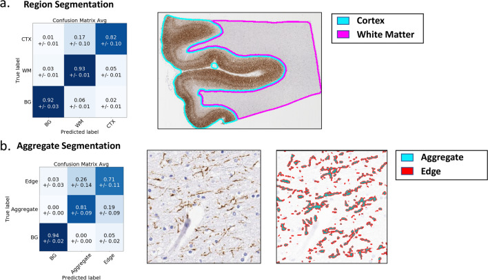 DL accurately identifies tissue regions and AT8-stained aggregates. For both region and aggregate models, a cross-validation scheme was used to generate multiple models, each trained on part of the data and evaluated on the rest. We report performance (left column) using confusion matrices which show how image areas with known true labels (rows) are assigned to different predicted classes (columns). Values denote fractions of patches/aggregates belonging to true class (i.e., rows add up to one) assigned to corresponding predicted class averaged across cross-validation models, with standard deviations shown in parenthesis. Right column shows sample classification results. Note: BG = Background. a Region segmentation: threefold cross validation was used and performance is measured in terms of fraction of image-patches from a region that are correctly classified (diagonal entries in dark blue). b Aggregate segmentation: twofold cross validation was used and performance is measured in terms of fraction of pixels that are correctly classified