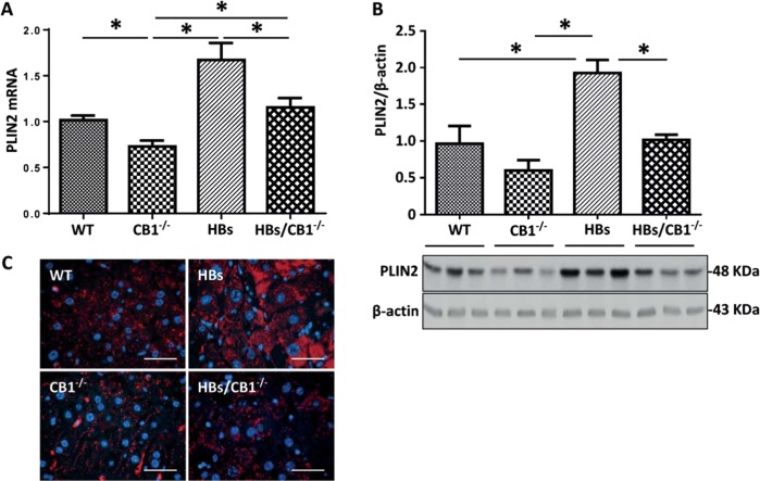 CB1 knockout reduced hepatic PLIN2 in HBs transgenic mice. a Quantitative real-time PCR analysis of PLIN2 revealed reduced PLIN2 mRNA in CB1−/− and HBS/CB1−/−-mice. Data were normalized to β-actin as reference gene and shown as relative expression (ΔΔCt). b Western blot analysis of total protein lysates from the liver of 52-week-old mice demonstrates reduced PLIN2 protein levels in HBs/CB1−/− mice. c Immunofluorescence analysis of paraffin-embedded liver sections from 52-week-old mice was performed using specific anti-PLIN2 antibody (red). Nuclei were stained with DAPI (blue). Original magnification ×1000, bar 40 µm