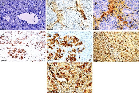 Immunohistochemical detection of CD34 (×40 & ×80). Sham group shows no positive reaction (a), mild increase in the reaction in both BDL (b & c) and silymarin groups treated groups (d & e) and highest reaction in the group treated with AM1241 (f & g). Notice the hepatic progenitor cells is well expressed in AM1241 treated group