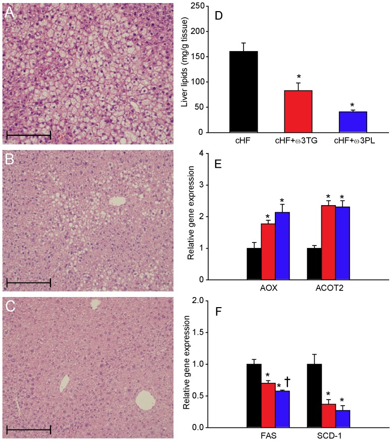 Reversal of hepatic lipid accumulation by dietary LC n-3 PUFA.Following a 4-month period of cHF-feeding, mice were fed for additional 9 weeks with cHF diet or treated using either cHF+ω3TG or cHF+ω3PL diet supplemented with 30 g DHA/EPA per kg; all diets also contained 2 g metformin per kg. Hematoxyline-eosin staining of liver sections from mice fed cHF (A), cHF+ω3TG (B), or cHF+ω3PL (C) diet. Hepatic lipid content (D). Quantification of mRNA levels of fatty acid oxidation (E) and lipogenic (F) genes in mice fed cHF (black bars), cHF+ω3TG (red bars), or cHF+ω3PL (blue bars) diets. A-C, Scale bars = 200 µm. AOX, acyl-CoA oxidase; ACOT2, acyl-CoA thioesterase 2; FAS; fatty acid synthase; SCD-1, stearoyl-CoA desaturase 1. Data are means±SEM (n = 7). *Significantly different from cHF (t-test or ANOVA); †significantly different from cHF+ω3TG (ANOVA).