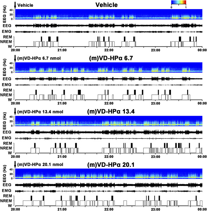 Effects of (m)VD-HPα i.c.v. injection on EEG and sleep–wake states. Representative 4-h (20:00–00:00) EEG power spectra (frequency 0–30 Hz), EEG, electromyogram (EMG), and hypnograms in rats treated with vehicle, 6.7, 13.4, and 20.1 nmol of (m)VD-HPα are shown. It should be noted that (m)VD-HPα (20.1 nmol) reduced latency to NREM sleep and induced an increase in NREM sleep accompanied by increased cortical 0.5–4.0 Hz activities and suppressed cortical 14.5–30 Hz activities.