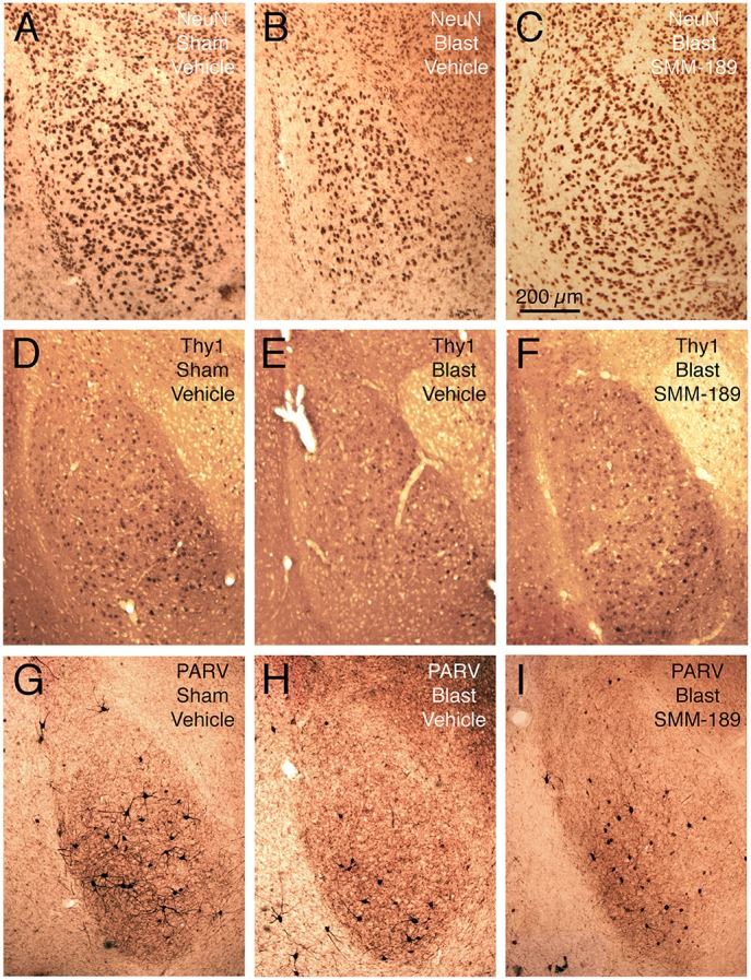 Images showing the effect of TBI and SMM-189 on NeuN+ neurons in left BLA (A–C), on Thy1+ fear-suppressing pyramidal neurons in left BLA in a Thy1-EYFP reporter mouse (D–F), and on PARV+ interneurons in left BLA (G–I). A reduction in NeuN+ neurons is seen in the 60-psi blast mice (B compared to A), which trended toward being rescued by SMM-189 treatment (C). Similarly, Thy1+ neurons of left BLA are reduced in the 60-psi blast mice (E), and rescued in the SMM-189 treated 60-psi blast mice (F), as also true for the PARV+ neurons of left BLA (G–I). Medial is to the right and magnification is the same in all images.