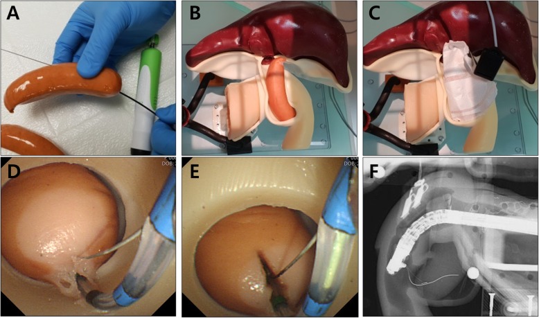 Endoscopic sphincterotomy using a Vienna sausage. a Making a small tract in a Vienna sausage as a vertical axis using an endoscopic ultrasound-guided biopsy needle; b Assembly of the sausage into the module area of the phantom; c Attachment of electrical plate to the sausage; d Endoscopic view of the exposed sausage at the ampullary area; e Endoscopic sphincterotomy after insertion of a guidewire and sphincterotome; f Fluoroscopic image of endoscopic sphincterotomy