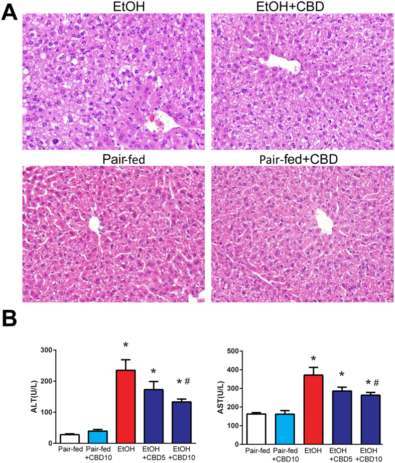 Effect of cannabidiol treatment on chronic-binge ethanol-induced liver injury. (A) Representative H&E staining of liver sections (B) and serum ALT, AST levels in indicated groups. Values represent means ± SEM (n = 4–7). *P < 0.05 vs. Pair-fed group, # P < 0.05 vs. EtOH group determined by One-way ANOVA, followed by Tukey’s post-hoc test.