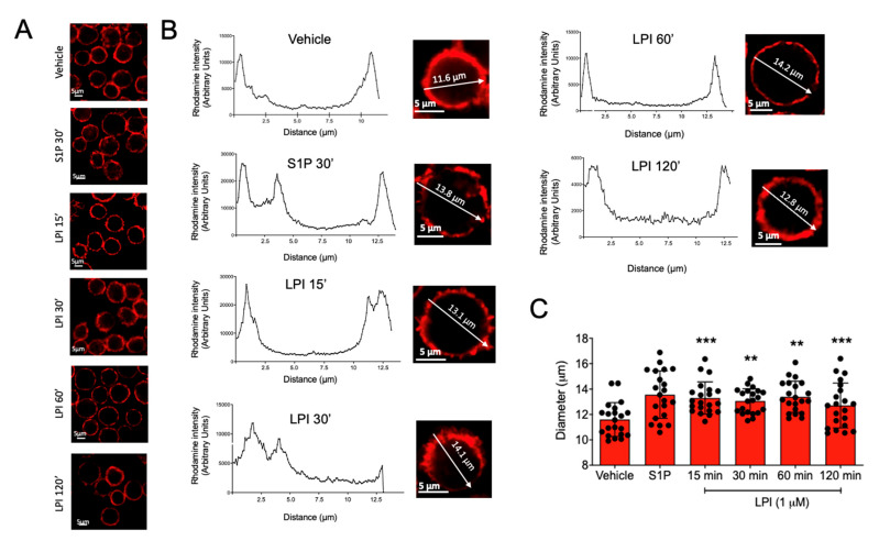 LPI-induced changes in cell size and actin ring polymerization in MCs. Panel (A): representative images of BMMCs stained with rhodamine-labeled phalloidin after treatments with vehicle, S1P (1 μM), and LPI (1 μM) at distinct times. Panel (B): representative images and analysis of cell size and the polymerization of the actin ring of BMMCs treated with S1P and LPI at distinct times. Utilizing the confocal microscopy software Zen 2.3 SP1 Blue Edition, a line was traced crossing at the equatorial plane of the individual cells and fluorescence values along the line were collected to calculate cell size using the graphs shown. Panel (C): quantification of changes in cell size induced by LPI in BMMC. Data are presented as the mean ± SEM of at least 20 cells analyzed under each condition; ** p < 0.01; *** p < 0.001 vs. vehicle.