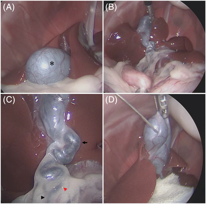 Laparoscopic observation of the biliary system was performed as follows. First, the gallbladder was observed under endoscopy from the fundus to the gallbladder body (A). As shown, the gallbladder (*) can be observed with a laparoscope. Afterward, by grasping and pulling the gallbladder and duodenum with laparoscopic Babcock forceps, it was possible to visually examine the entire image of the liver, gallbladder, cystic duct, and common bile duct (B). Further, the gallbladder (*), cystic duct (arrow), common bile duct (arrowhead), and hepatic duct (red arrowhead) can be observed in detail when approached with a rigid scope (C). Then, laparoscopic cholecystocentesis was performed to collect a bile sample. Under laparoscopy, the puncture could be performed while directly observing the gallbladder. Gauze (*) was used to protect the organs to ensure that the bile sample could be collected safely (D)