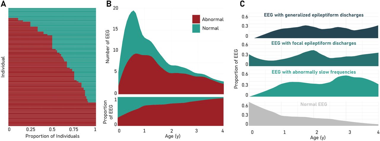 EEG features of individuals with SCN1A-related disorders. (A) Proportion of normal/abnormal EEGs (x-axis) per individual (y-axis). Color as indicated in legend. (B) Distribution of EEGs by age (x-axis) and by normal/abnormal status. Color as indicated in legend. (C) Smoothed frequency of different categories of EEG abnormality by age. X-axis represents age in years, and y-axis represents the proportion of EEGs with a particular abnormality. The proportion of normal EEGs are shown for reference in grey.