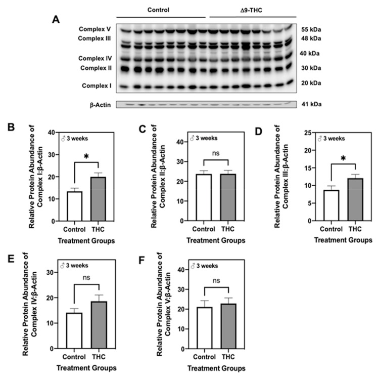 Gestational exposure to Δ9-tetrahydrocannabinol (Δ9-THC) leads to increased complexes I and III of the electron transport chain in male offspring at three weeks of age. (A) Representative western immunoblots illustrating hepatic expression of complexes I–V of the electron transport chain in male offspring at three weeks of age. Protein abundances of complex I (B), II (C), III (D), IV (E) and V (F) were normalized to β-Actin ± SEM (n = 7–8/group). All protein abundances were analyzed using a two-tailed unpaired Student’s t-test. * Significant difference (p < 0.05).