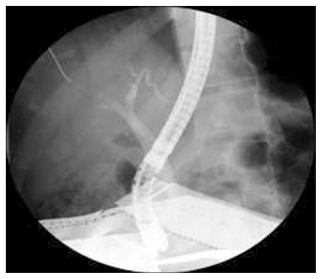 The pelvis of the patient was covered with a lead apron (case 4).