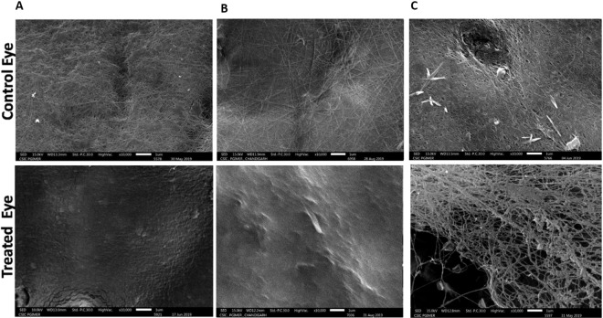 Scanning electron photomicrographs of the inner retinal surface of 3 representative animals treated with CBD and RCBD. In test eyes with complete PVD (Panels A and B), the retinal surface was devoid of any collagen fibers; in eyes with partial PVD (Panel C), there was less vitreous cortex left on the retinal surface, compared to the corresponding control (contralateral) eyes (PBS) with no PVD, where dense vitreous cortical fibers were visible (** Scale Bar 1 µm or 10000X magnification).