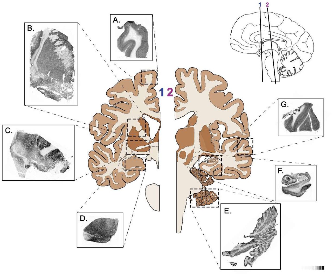 Representative autoradiograms of [35S]GTPγS stimulated by specific agonist of S1P1 receptor, CYM-5442 (10 μM), in human frontal cortex (A), striatum (B), basal forebrain (C), amygdala (D), cerebellum (E), hippocampus (F) and temporal cortex (G). [14C]-Standard (0-35000 nCi/g t.e.).