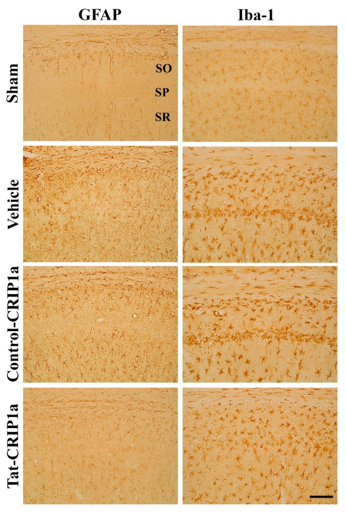 Immunohistochemistry for glial fibrillary acidic protein (GFAP) and Iba-1 in the cornu Ammonis (CA)1 region of the sham, vehicle, Control-CRIP1a, and Tat-CRIP1a groups at 4 days after ischemia. In the vehicle group, GFAP-immunoreactive astrocytes have hypertrophied cytoplasm and processes and ionized calcium-binding adapter molecule 1 (Iba-1)-imunoreactive microglia with hypertrophied cytoplasm with retracted processes. In the Tat-CRIP1a group, astrocytes and microglia with activated phenotypes were markedly decreased. Scale bar = 100 µm. SO, stratum oriens; SP, stratum pyramidale; SR, stratum radiatum.