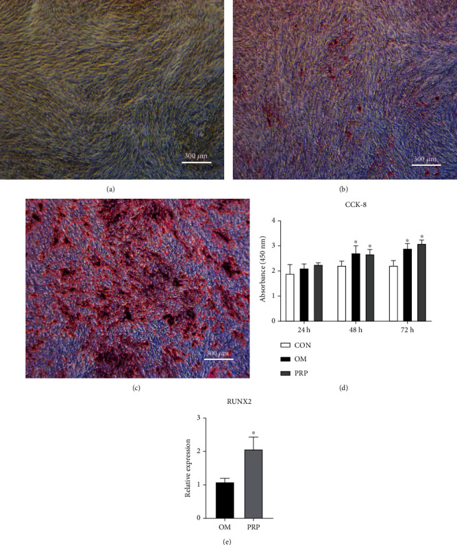 PRP promotes the proliferation of hADSCs and the formation of calcium nodules. (a) No calcium nodules were formed in the CON group as indicated by the lack of Alizarin Red staining. (b) Few calcium nodules were formed in the OM group as indicated by Alizarin Red staining. (c) Many calcium nodules were formed in the PRP group as indicated by Alizarin Red staining. (d) The effect of the different culture media on the proliferation of hADSCs was evaluated by a CCK-8 assay (∗ vs. con, P < 0.05, n = 5). (e) Change in the expression of Runx2 (∗ vs. OM, P < 0.05, n = 3).