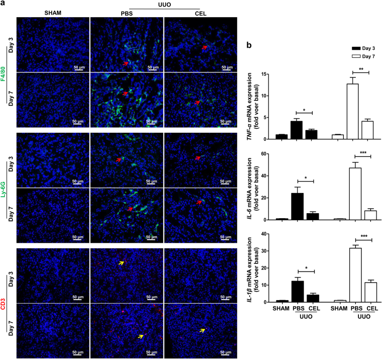 Celastrol inhibits UUO-induced inflammatory responses.The mice received celastrol (1 mg/kg) daily from the day of surgery. The vehicle-treated mice were treated with an equal volume of PBS, and the sham group was the control for UUO. Kidney tissues were collected at days 3 and 7 after UUO. a Representative micrographs of the infiltration of macrophages (F4/80+, red arrows), neutrophils (Ly-6G+, red arrows) and T lymphocytes (CD3+, yellow arrows) in kidney tissues using immunohistochemical staining. b The expression of pro-inflammatory cytokines TNF-α, IL-6, and IL-1β in kidney tissues was measured using qRT-PCR. All values are represented as mean ± SEM. Scale bar = 50 μm. n = 5/group. *P < 0.05, **P < 0.01, and ***P < 0.001