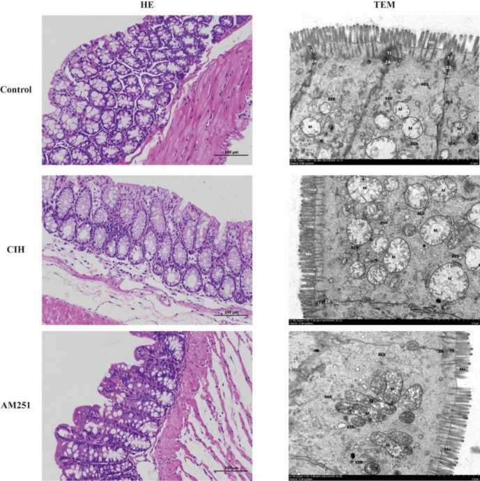 Inhibiting CB1 receptor mitigated the pathological damage of colon induced by CIH. Representative image of HE staining (100 µm) and transmission electron microscopy (20 µm) of colon tissue. TEM, transmission electron microscopy