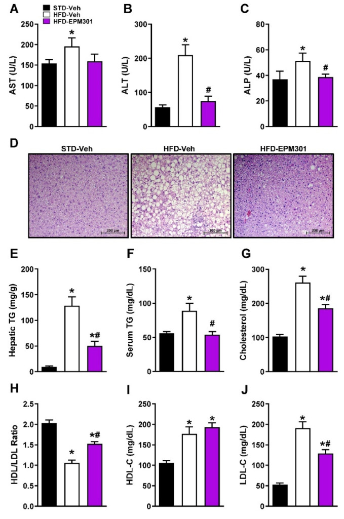 EPM301 restores liver function and lipid homeostasis in DIO C57Bl/6J mice. Daily chronic treatment of HFD-induced obese C57Bl/6J mice with EPM301 (40 mg/kg/day, i.p.) for 28 days reduced the HFD-induced hepatic injury and steatosis, as manifested by the reduced serum levels of AST (A), ALT (B), and ALP (C), along with a reduction in lipid vacuoles in hepatocytes (D) and hepatic triglyceride (TG) content (E). EPM301 improved the serum lipid profile, as manifested by reduced serum TG (F) and total cholesterol (G). EPM301 increased the HDL/LDL ratio (H) without changing the HDL levels (I) but still reduced the LDL levels (J). Data represent the mean ± SEM from 5–6 mice per group. * p < 0.05 relative to STD-Veh; # p < 0.05 relative to HFD-Veh.