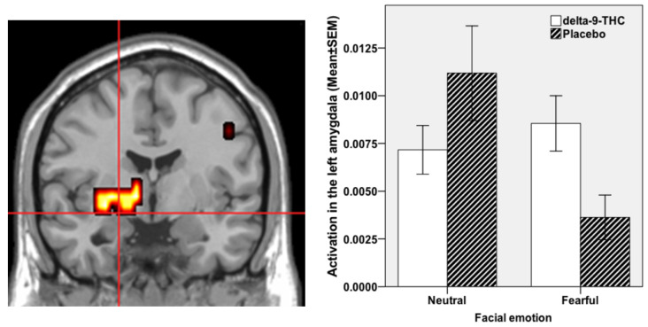 Brain activation whilst viewing fearful faces in comparison to neutral faces under THC condition compared to Placebo. Activation shown in the left parahippocampal gyrus and amygdala (cross-hairs in the coronal view; cluster size = 18 voxels; Talairach coordinates: x = −29, y = −4, z = −7; x = −29, y = 7, z = −13; p < 0.003 corrected for <1 false positive cluster). The left side of the brain is shown on the left side of the image. Accompanying plot on the right shows activation in the amygdala under the different fear (fearful vs neutral faces) and drug (THC vs PLB) conditions.