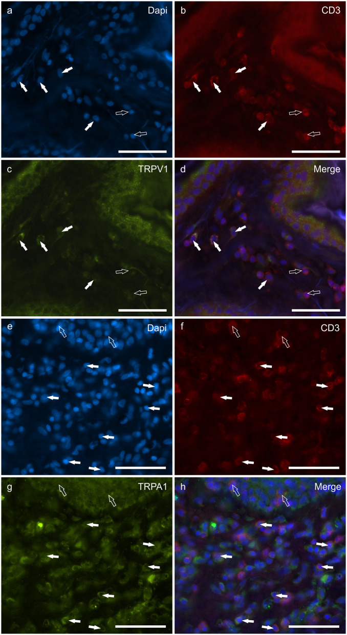 Photomicrographs of the cryosections of the skin of dogs with atopic dermatitis (AD) showing CD3 immunoreactive T lymphocytes expressing transient receptor potential vanilloid 1 (TRPV1) (a–d) and transient receptor potential ankyrin 1 (TRPA1) (e–h) immunoreactivity (IR). (a–d) The white arrows indicate the dapi-labeled nuclei of some CD3 immunoreactive T lymphocytes co-expressing TRPV1-IR (C). The open arrows indicate the nuclei of CD3-IR cells which were TRPV1 negative. (e–h) The white arrows indicate the Dapi-labeled nuclei of some CD3 immunoreactive T lymphocytes co-expressing TRPA1-IR (g). The open arrows indicate the nuclei of two intraepithelial CD3 immunoreactive lymphocytes (f). Bar: 50 μm.