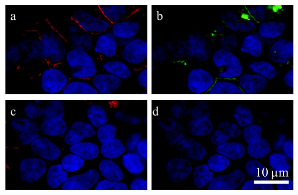 GPR18 antibody recognizes hGPR18 receptors stably expressed in HEK293-GPR18 cells. Immunofluorescent confocal microscopy was conducted using HEK293 cells stably transfected with HA11-tagged hGPR18 and HA11 (1:500) and GPR18 (1:500) antibodies. a, HA11 antibody (detected with Texas Red secondary; red) staining shows HA11-hGPR18 transfected cells. b, hGPR18 antibody (detected with FITC secondary; green) staining of the same cells identified with the HA11 antibody. c, HA11 antibody (detected with Texas Red secondary; red) staining shows HA11-hGPR18 transfected cells. d, hGPR18 antibody staining (detected with FITC secondary; green) was blocked when the GPR18 antibody was co-incubated with immunizing protein (30 μg/ml) for 1 hour before administration. DAPI (1.5 μg/ml; blue) was used to label the nucleus of all HEK293-GPR18 cells.