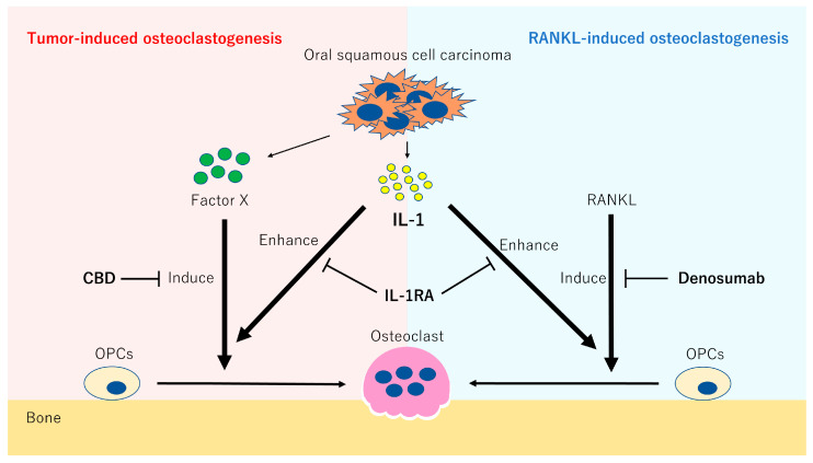 Hypothesis of the mechanism of bone resorption induced by the infiltration of OSCC.