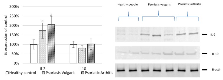 The expression of interleukins and pro-inflammatory mediators in mononuclear cells from patients with psoriasis vulgaris (n = 16), psoriatic arthritis (n = 8), and healthy subjects (n = 8). IL-interleukine. Data points represent the mean ± SD; a, significantly different from healthy subjects, p < 0.05.