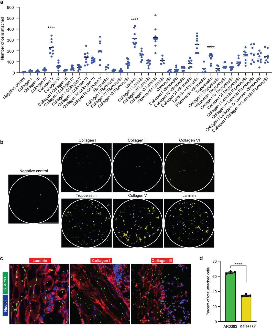 Als4112 mediates C. auris adherence to ECM proteins.(A) The number of cells attached to human ECM protein prints, counted with CellProfiler. (B) Fluorescence microscopy images showing adhesion of AR0383 Eno1-RFP cells to human ECM protein prints, highlighted by circles. Yellow dots represent C. auris cells, shown in pseudo color. Scale bar, 100 μm. (C) In situ incubation of C. auris on mouse skin shows co-localization with laminin, but not collagen I or III. Scale bar, 50 μm. (D) The number of AR0383 Eno1-RFP and AR0383 Δals4112 cells that remained attached to laminin-coated glass coverslips after washing were counted. The percentage of attached cells for each strain relative to the total number of attached cells was plotted. Values represent the mean ± s. d., calculated from three biological replicates. Statistical differences were assessed using one-way ANOVA with Dunnett’s multiple comparisons test (A) or unpaired t test (D); ****P ≤ 0.0001.