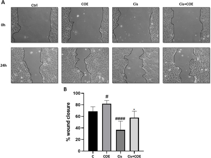 Podocytes cell migration. A representative pictures show the migration of podocyte cells after induction of a scratch representing wound. All the pictures were caught immediately after the scratch was induced (at zero hour) and after 24 h of incision. Podocytes on the pictures were cultured in different conditions as indicated. Pictures are taken at 10 times magnification. B The relative change in cell-free gap surfaces was measured at different time points after creation of the wounding scratch and expressed as fold change over zero time. Results are expressed as mean ± SEM of three independent experiments performed in triplicate. Statistictical analysis was performed using two-way ANOVA followed by Bonferroni’s multiple comparison test. # P < 0.05 vs. control, ###P < 0.001 vs. control, *P < 0.05 vs. cisplatin