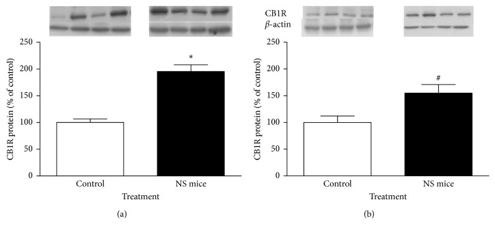 Western blot analysis of relative levels of CB1R in epididymal fat (a) and liver (b) of control and NS mice at 150 days. For densitometry quantification purposes, β-actin was used as a loading control. Results are expressed as percentage relative to CB1R expression in control mice. ∗P < 0.05; #P=0.06 (Mann–Whitney U test; mean ± SEM; n=5 mice/group). Four representative blots are shown.