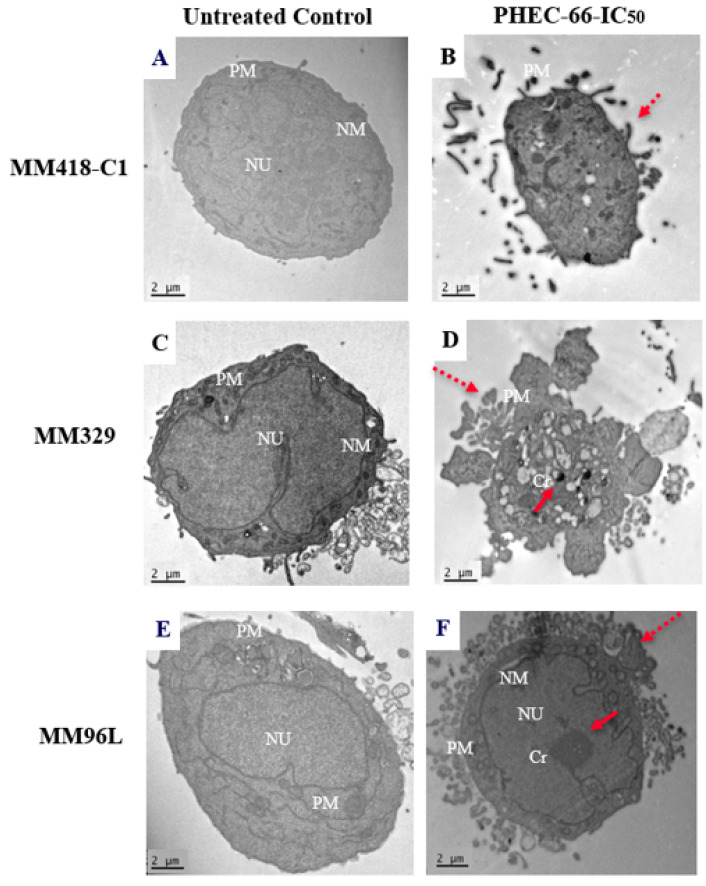 Effect of PHEC-66 on the morphology of MM418-C1, MM329, and MM96L melanoma cells. The cells were treated with the PHEC-66 at their respective IC50 concentrations for 48 h and then examined under TEM. Solid-line arrow: chromatin condensation, dotted-line arrow: cell membrane blebbing, NU: nucleus, NM: nuclear membrane, Cr: chromatin condensation, PM: plasma membrane. (A) MM329 control cells, (B) PHEC-66-treated MM329 cells, (C) MM418-C1 control cells, (D) PHEC-66-treated MM418-C1 cells, (E) MM96L control cells, (F) PHEC-66-treated MM96L cells (Scale bar = 2 µm).