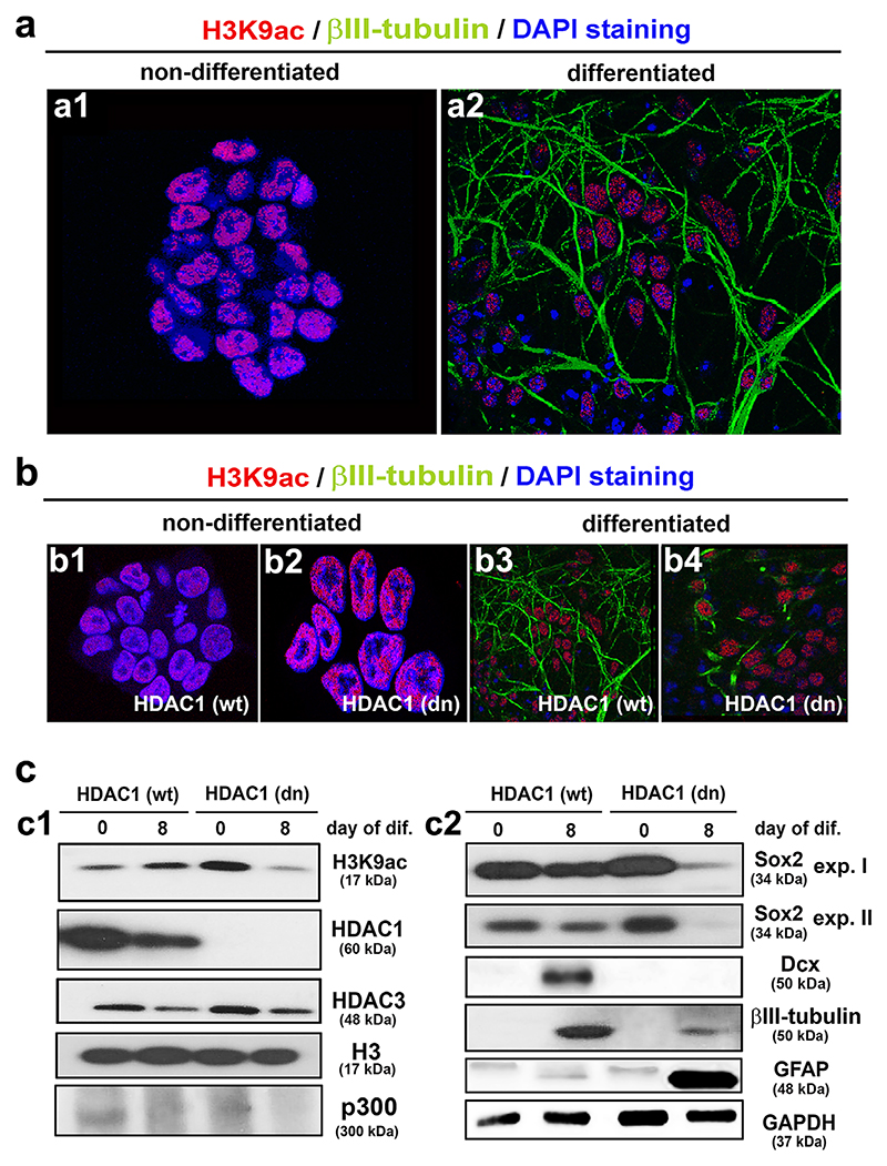 The distribution pattern of H3K9ac and the levels of histone-related markers in HDAC1 (wt) D3 mESCs and HDAC1 (dn) control mouse embryonic stem cells (mESCs) in cells undergoing neural differentiation.(a) H3K9ac (red) is shown in (a1) non-differentiated (wt) D3 mESCs and (a2) cells undergoing differentiation as indicated by βIII-tubulin positivity (green). (b) H3K9ac (red) and βIII-tubulin (green) in (b1) non-differentiated (wt) mESCs, (b2) non-differentiated HDAC1 (dn) mESCs, (b3) differentiated (wt) mESCs, or (b4) differentiated HDAC1 (dn) mESCs. DAPI (blue) was used to counterstain the cell nuclei. (c) Western blot analysis revealed the levels of (c1) H3K9ac, HDAC1, HDAC3, histone H3,and p300 or (c2) the neuronal marker Sox2 (two images of different expositions), Dcx, βIII-tubulin, and GFAP in non-differentiated and differentiated (wt) D3 mESCs and HDAC1 (dn) mESCs. GAPDH was used as the reference protein for the neural markers, and histone H3 was used as the reference for markers of the acetylome